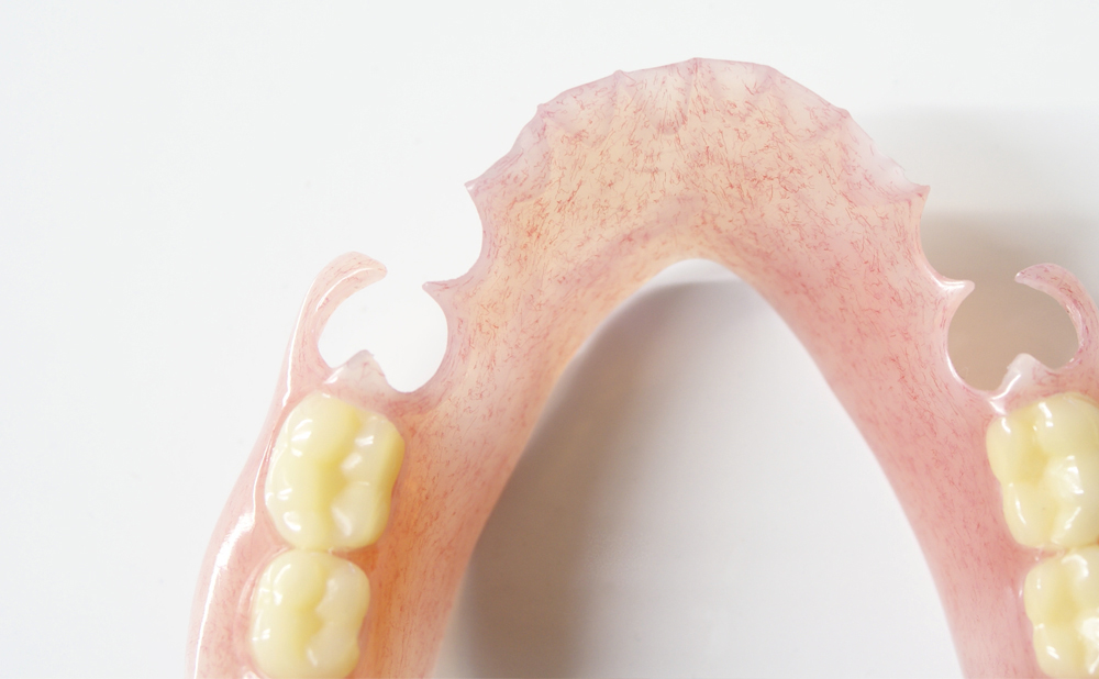 ノンクラスプデンチャー | 審美系義歯や高精度義歯は株式会社足利セラミックラボラトリーで