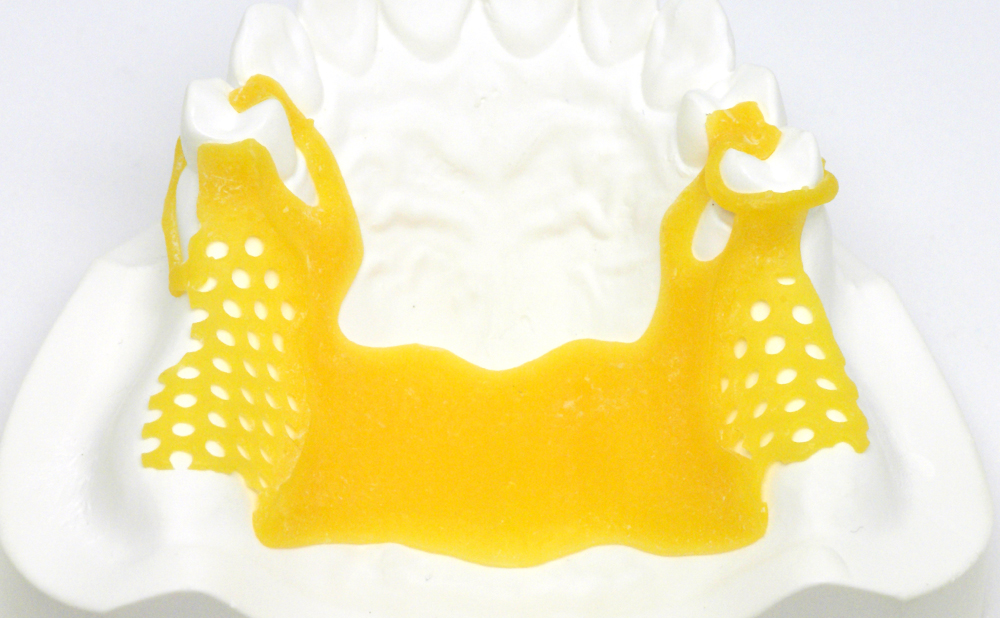 3dプリント デジタル歯科の最先端 株式会社足利セラミックラボラトリー